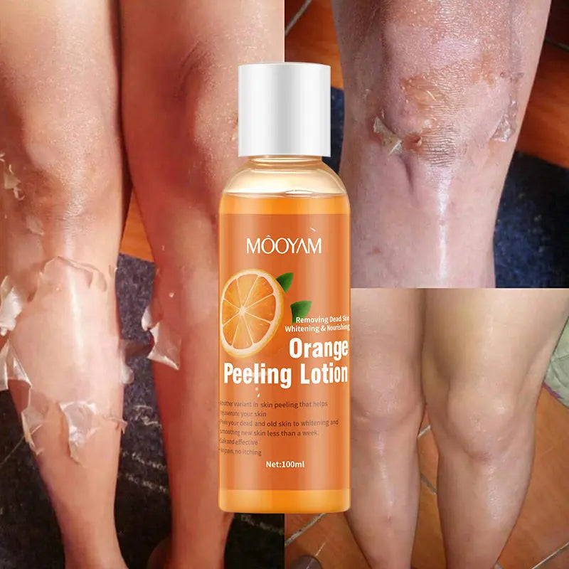 Orange Peel Lotion Peeling Oil Body Lotion Gentle Exfoliation My Store